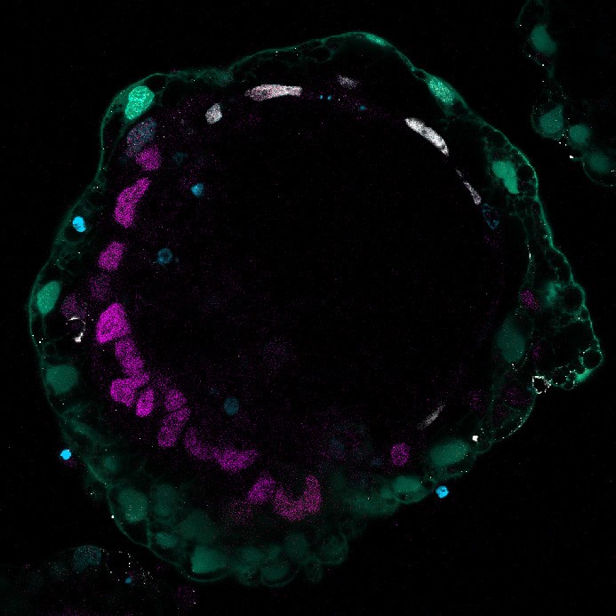 ナイーブ型ヒト多能性幹細胞による非統合胚モデルを用いて 着床前から原腸陥入初期までのヒト初期発生を再現