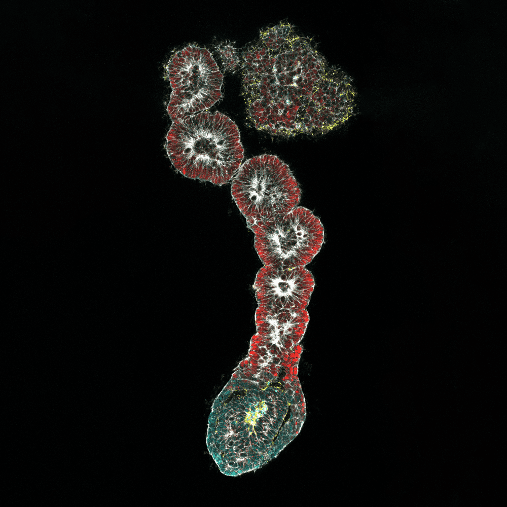 ヒト胚での3D 体節形成モデルをiPS 細胞から確⽴