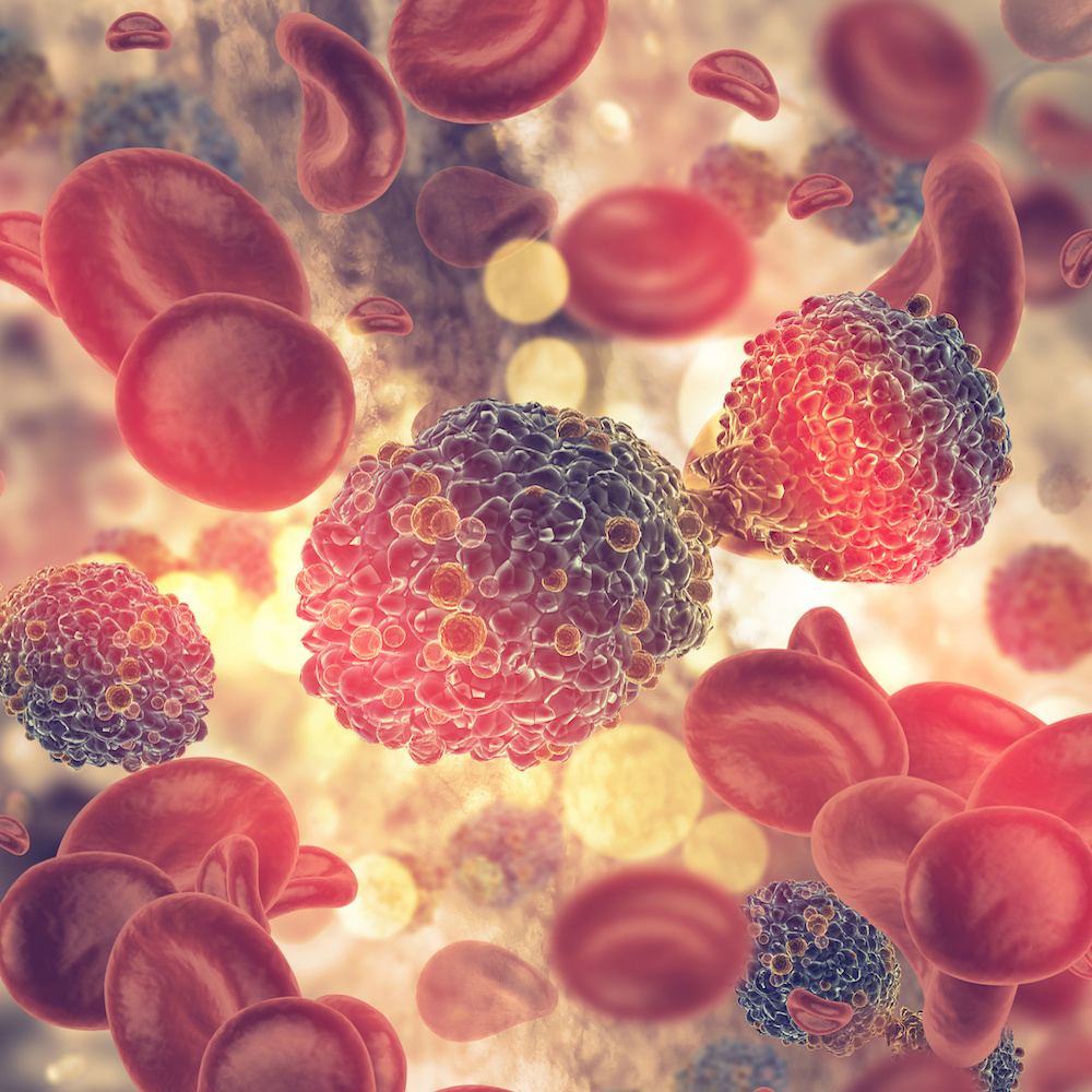 成人T細胞白血病リンパ腫の多段階発がん分子メカニズムを解明