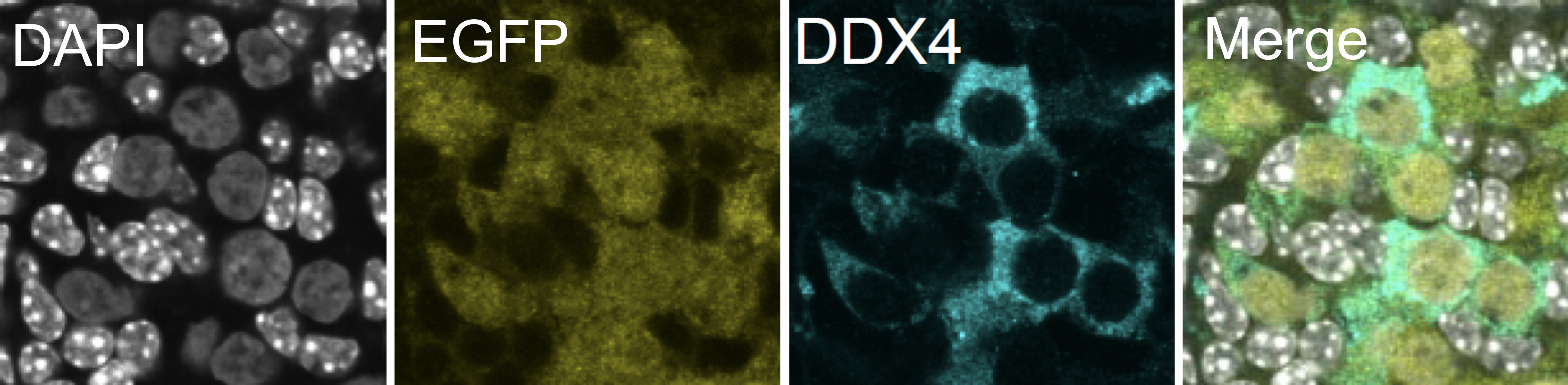増殖したヒト始原生殖細胞様細胞(EGFP陽性、黄色)は再構成卵巣内で卵原細胞様細胞(DDX4陽性、シアン)へと分化する
